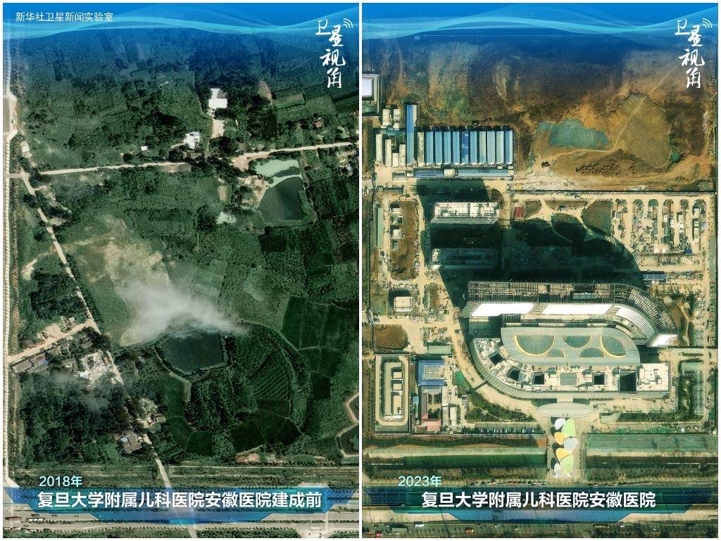 2023年與2018年相比，復(fù)旦大學(xué)附屬兒科醫(yī)院安徽醫(yī)院從一片荒地到建成投用。該項目是安徽省在長三角一體化高質(zhì)量發(fā)展衛(wèi)生健康領(lǐng)域的重大項目，也是安徽首批落地的國家區(qū)域醫(yī)療中心。